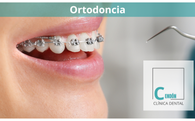 Problemas comunes de ortodoncia y cómo solucionarlos en Vigo