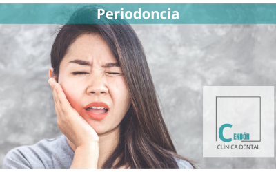 Periodoncia: El secreto para una sonrisa saludable a largo plazo