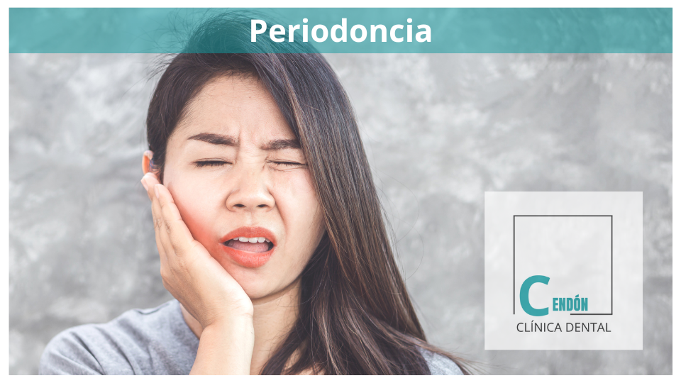 Periodoncia: El secreto para una sonrisa saludable a largo plazo
