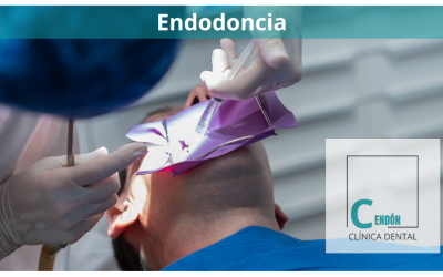 Endodoncia: Soluciones eficaces para el dolor y la infección dental