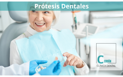 Las ventajas de elegir prótesis dentales fijas sobre removibles