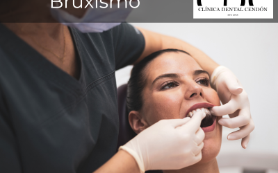 Bruxismo: Cómo Identificar y Tratar el Rechinamiento de Dientes