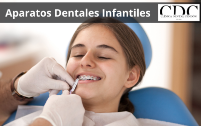 Aparatos dentales para niños: Lo que los padres deben saber
