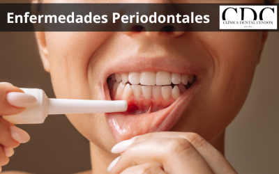 Prevención de enfermedades periodontales: Consejos de nuestra especialista, Patricia de Vargas