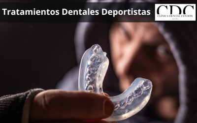 Tratamientos dentales para deportistas: Protege tu sonrisa durante la actividad física