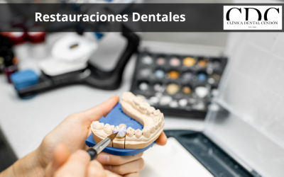 Restauraciones dentales: Opciones para reparar y embellecer tus dientes