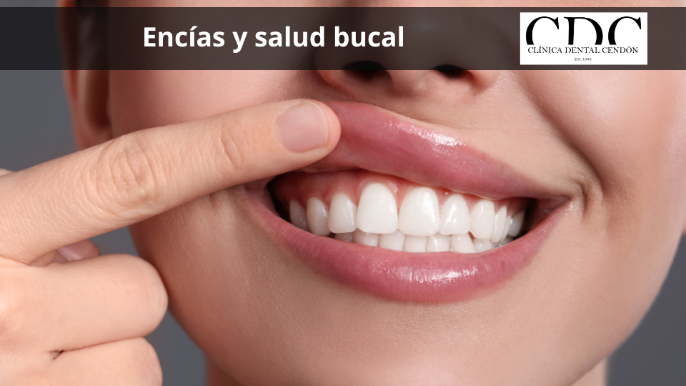 El papel de las encías en tu salud bucal: Cómo mantenerlas en óptimas condiciones