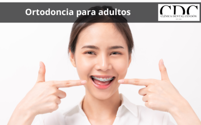 ¿Cuándo es el mejor momento para comenzar un tratamiento de ortodoncia en adultos?
