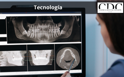 ¿Es la tecnología un factor clave para elegir una clínica dental en Vigo?