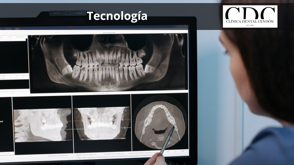 ¿Es la tecnología un factor clave para elegir una clínica dental en Vigo?