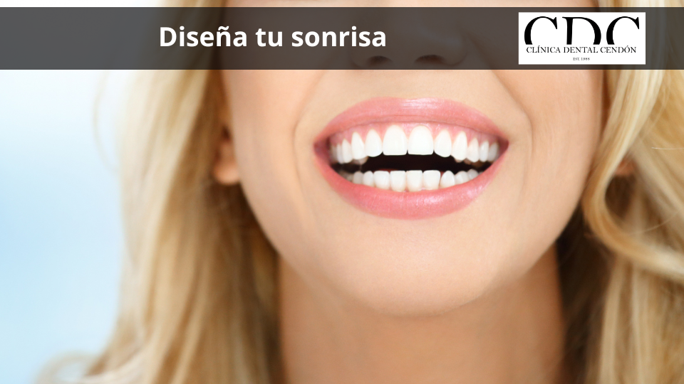 Diseña tu sonrisa